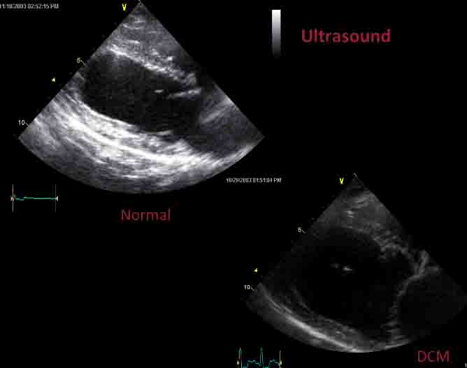 congenital-heart-defects-symptoms